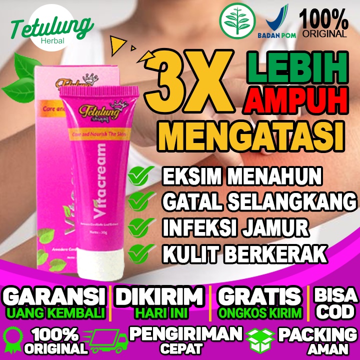 Salep Gatal Selangkangan Dan Kemaluan yang ampuh menghilangkan kulit berkerak dan infeksi jamur