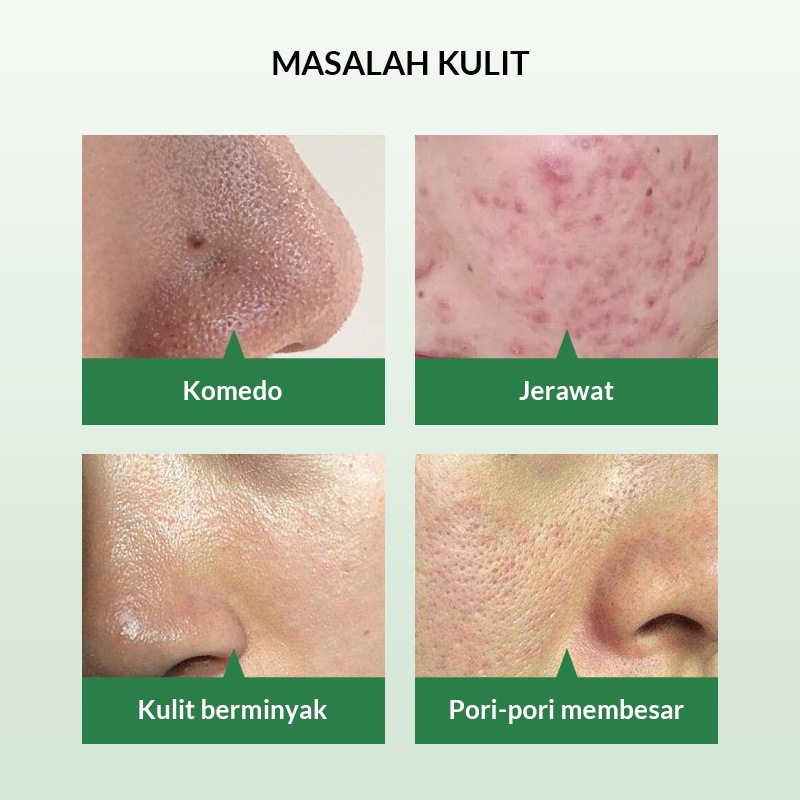 Bioaqua Pore Minimizer Mask With Saliyclic Acid Mask / Masker Wajah Berjerawat 25g