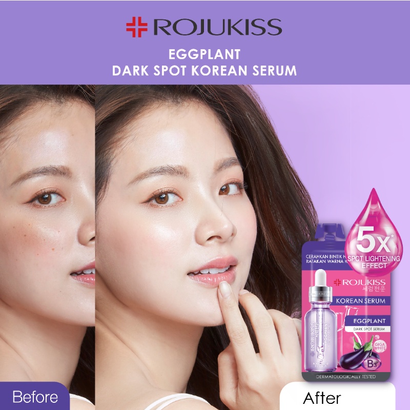 [BPOM] Rojukiss Eggplant Dark Spot Korean Serum 8ml - Serum Memudarkan Bintik Hitam