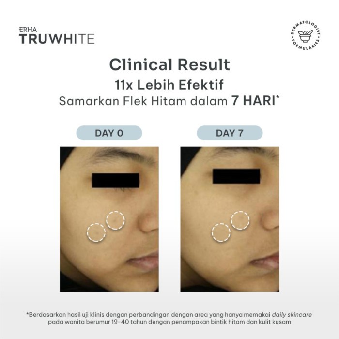 ERHA Truwhite Niacinamide &amp; Peptide Dark Spot Corrector