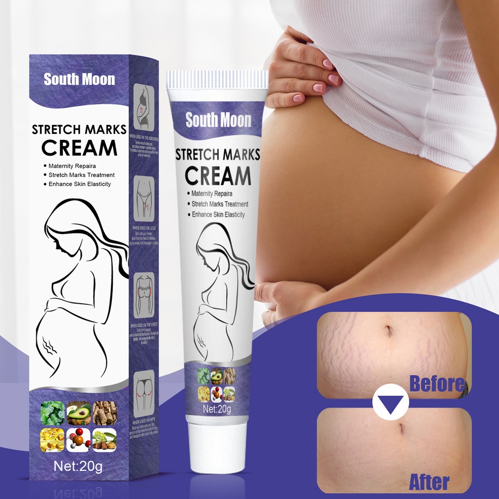StretchMark Cream Stretch Mark Treatment Penghilang Bekas Luka Penghilang Strech Mark
