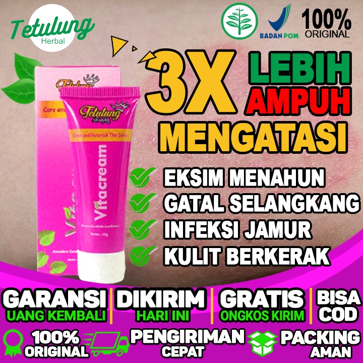 Obat Jerawat Besar Seperti Bisul  Obat Jerawat Bisul  Obat Bisul Di Jidat Obat Eksim Menahun Yang Am