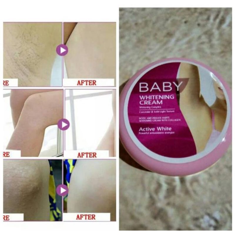 BABY WHITENING CREAM - CREAM KETIAK LEHER LIPATAN DLL