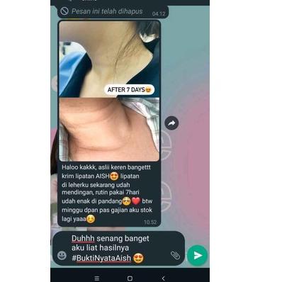 BAYAR DITEMPAT✔️BISA COD AISH UNDERARM CREAM / AISH C BRIGHT AISH C BRIGHT UNDERARM CREAM / AISH UND