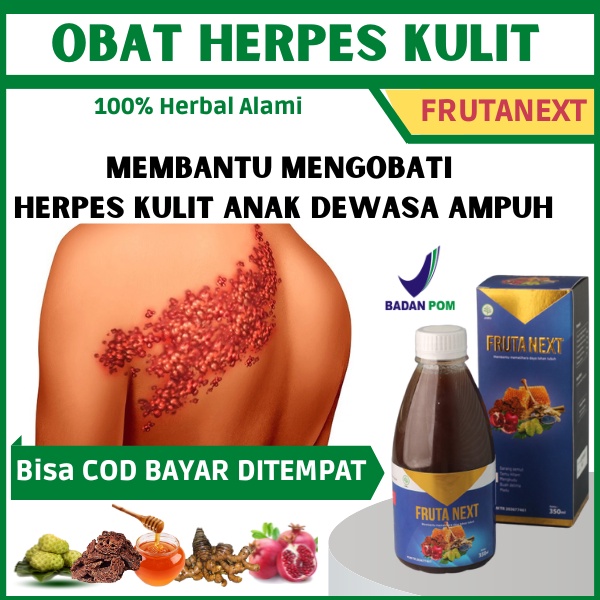 Obat Gatal Herpes Kulit - Frutanext Penghilang Herpes Paling Ampuh