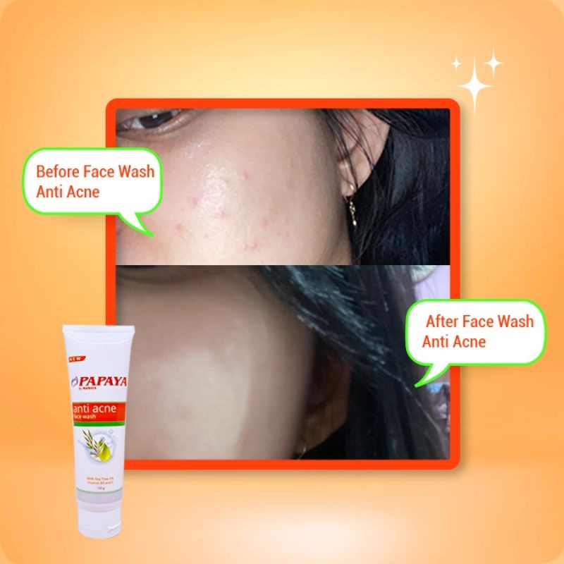 Papaya Mamaya Anti Acne Face Wash 100gr/Sabun Wajah Ance/BPOM