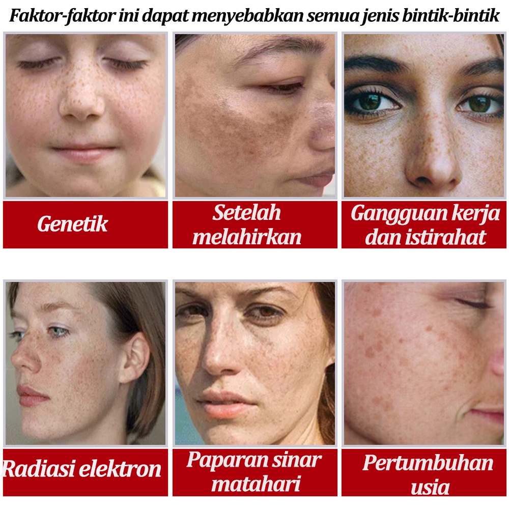 krim pemutih Bintik Cream penghilang flek hitam Krim Pemutih wajah 30g penghilang flek hitam di wajah Efektif Menghilangkan Bintik Melanin Dan Perawatan