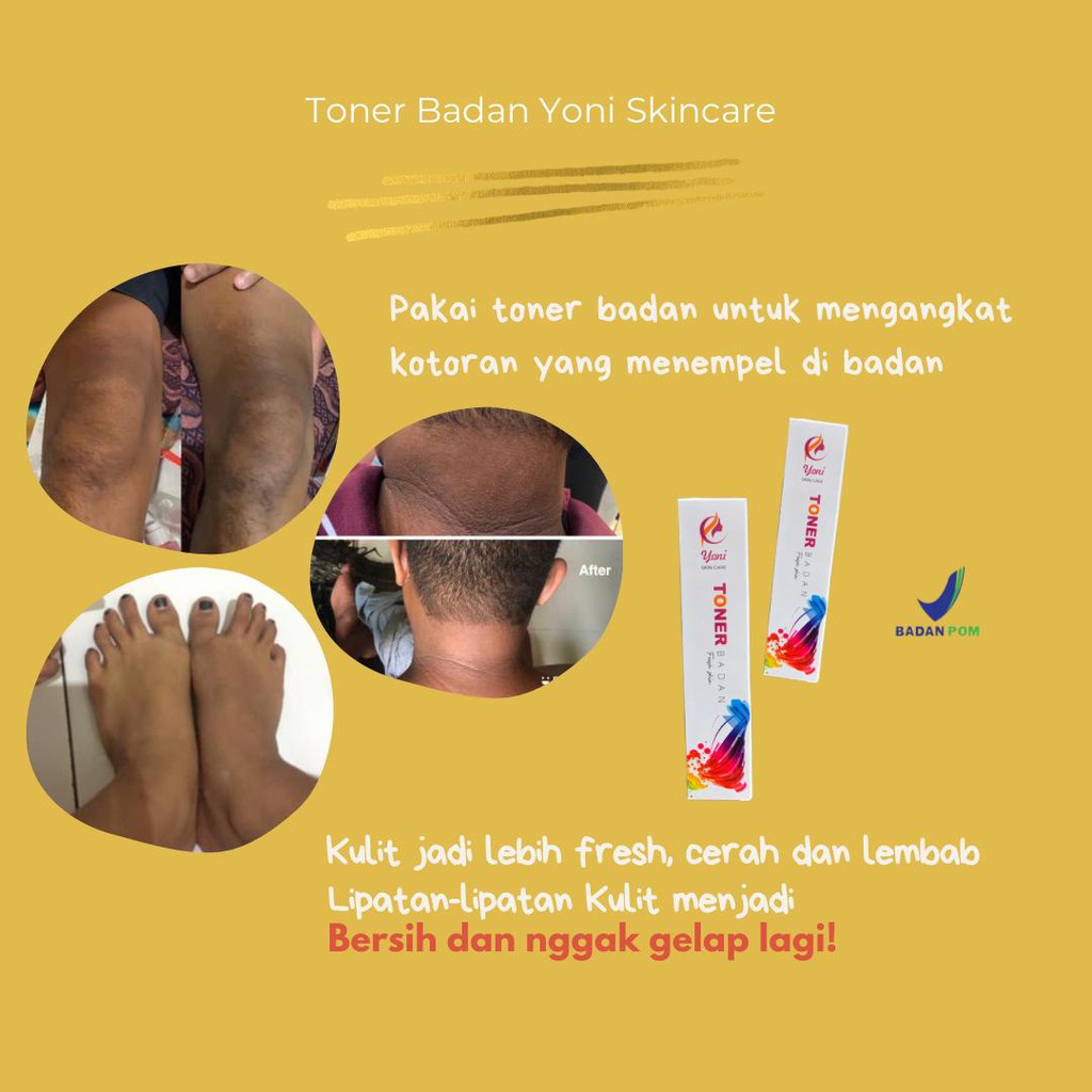 YONI SKINCARE TONER BADAN AMPUH MENGANGKAT DAKI KULIT MATI BODY TONER
