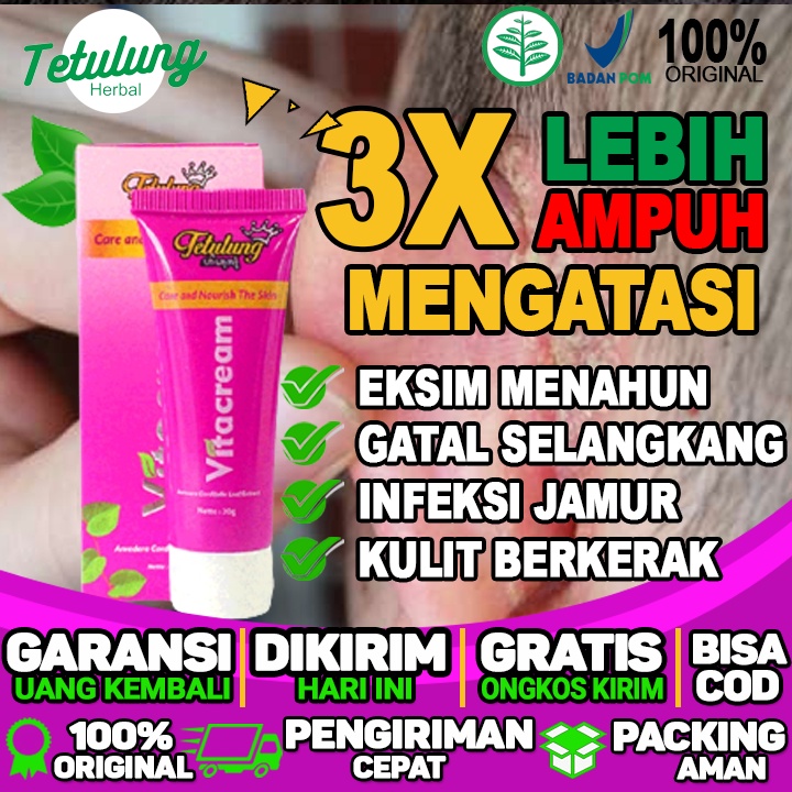 obat eksim gatal obat gatal eksim kering obat gatal eksim basah dan menghilangkan infeksi jamur