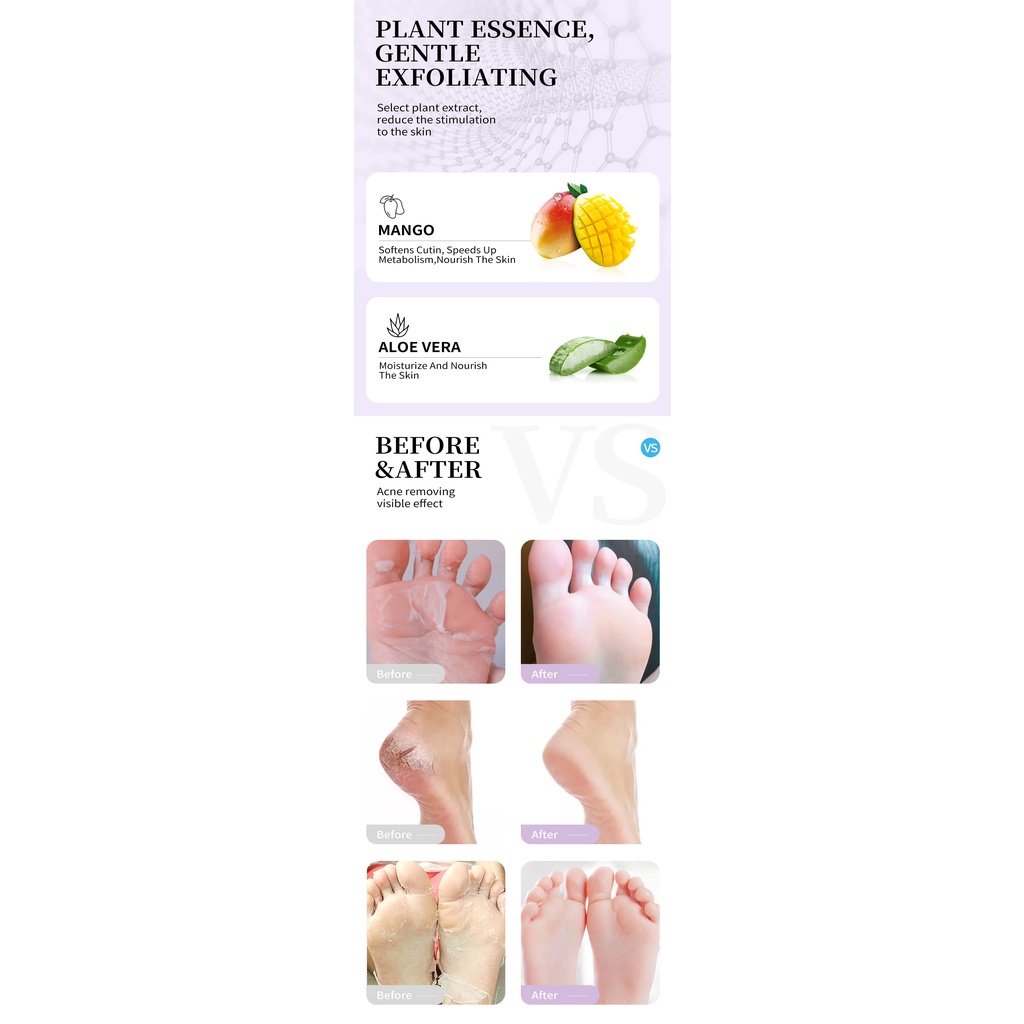 RTOPR Mango Remove Dead Skin Exfoliating Improve Beri Beri Foot Mask