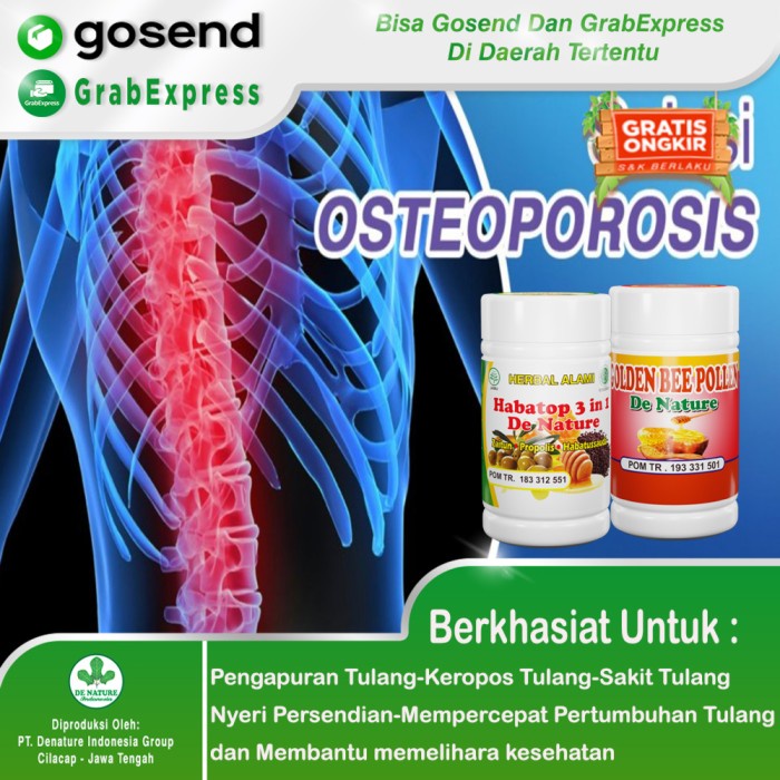 OBAT PENGAPURAN TULANG,OBAT OSTEOPOROSIS,TULANG KEROPOS,KURANG CALSIUM TERLARIS