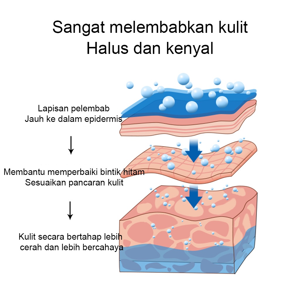 ORIGINAL Penghilang flek hitam Salep Flek Hitam Melasma Ampuh Remedy Black Spots Remedy 20g krim bintikPenghapusan Bintik Hitam