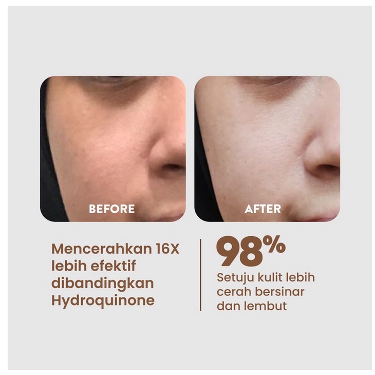 B87 N'PURE licorice potion of light serum wajah mencerahkan essence perawatan kecantikan bpom murah termurah original asli mengatasi bekas jerawat bruntusan beruntusan anti aging garis halus baru best seller dark spot skin barrier