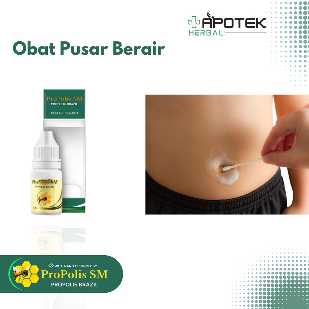 Obat Pusar Berair, Pusar Bernanah, Obat Luka di Pusar, Infeksi Luka, Obat Pusar Gatal, Bau, Obat Tet