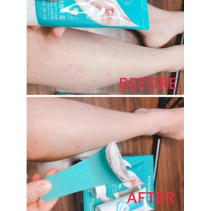 Spesial Edition--YOFUME PERONTOK BULU