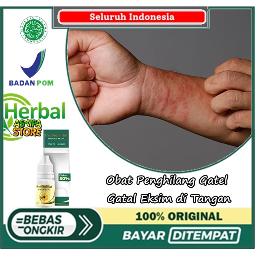 Obat Penghilang Gatel - Gatal Eksim di Tangan | Salep Cair Kulit Kering, Infeksi Jamur atau Kutu Air
