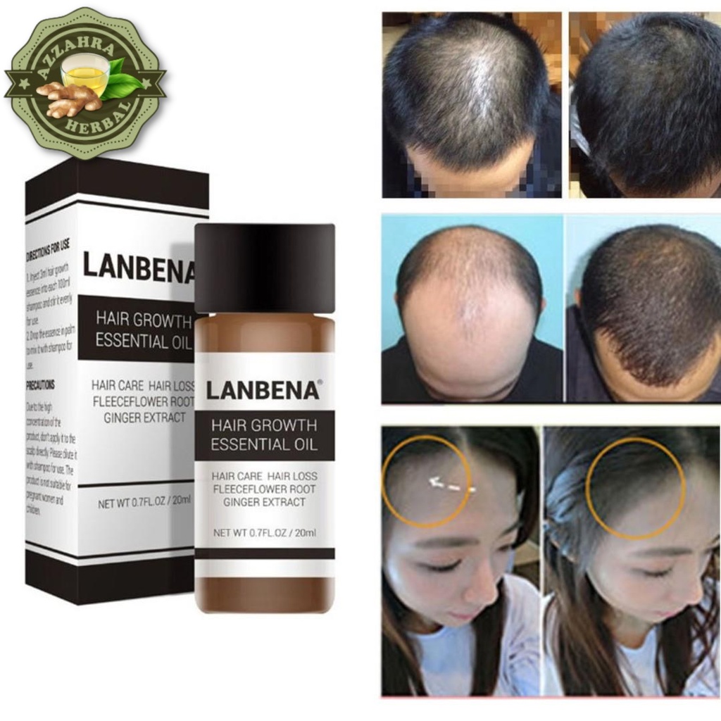 Penumbuh Rambut Botak Dan Rontok Pria Wanita Cepat Serum Essence Penghitam Uban Penyubur Original / LANBENA Hair Growth Oil