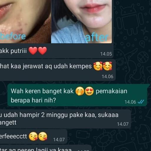 BISA COD ✔️SERUM AISH KOREA | AISH SERUM ORIGINAL | SERUM AISH ORIGINAL | AISH SERUM KOREA BPOM / AI