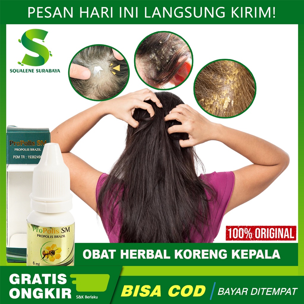 Jual Propolis Sm Asli Cod Obat Koreng Di Kepala Luka Koreng Di Kulit Kepala Obat 7292