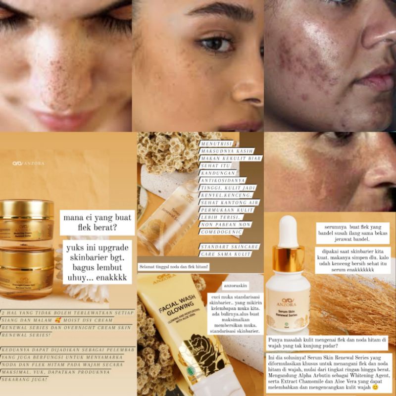 ANZORA SKINCARE - Anzora Skincare Original/Paket Glow/Paket Acne/Paket Removerdarksport (free gifh)