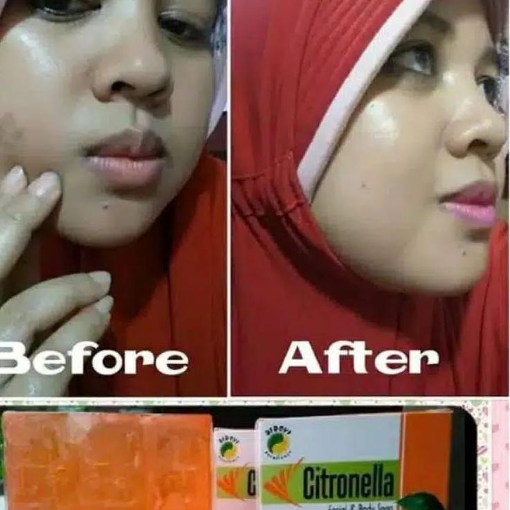 Disc Xtra--Sabun Citronella 80 gram Sabun Bidoyi Citronella Original halal bpom