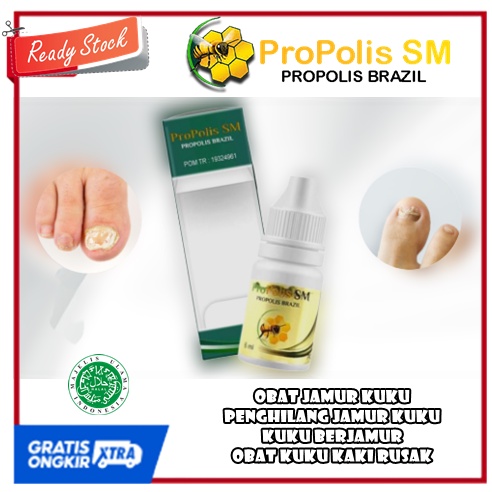 obat jamur kuku, penghilang jamur kuku, kuku berjamur, obat kuku kaki rusak, obat kuku rusak, obat k