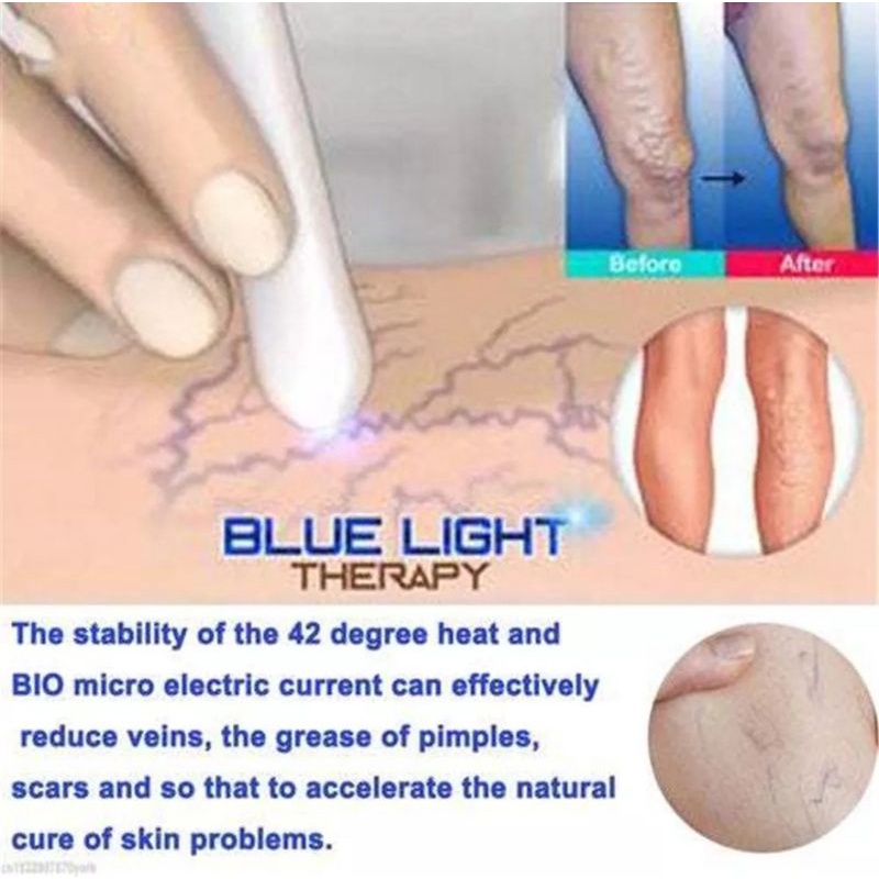 Alat laser terapi scar keloid acne jerawat selulit