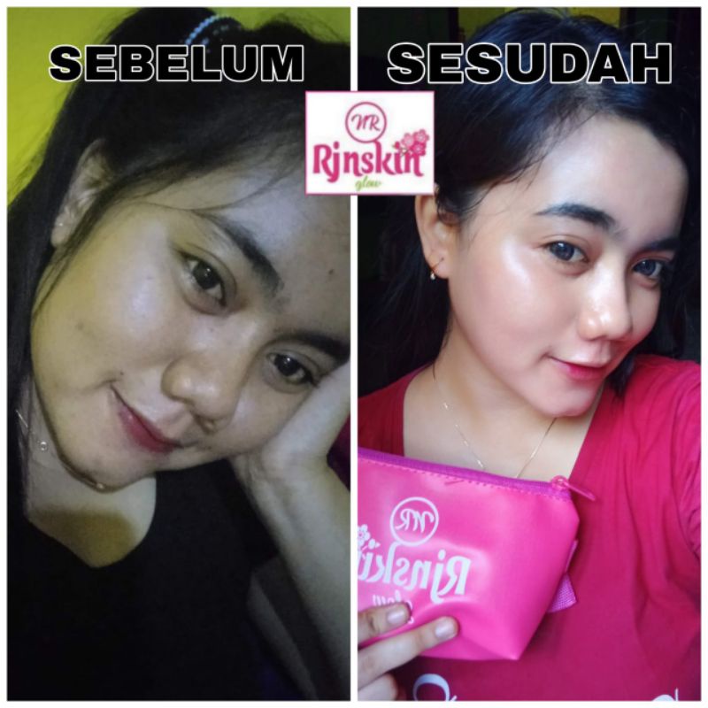 PEKET SKINCARE/PELICIN PEMUTIH WAJAH NRGLOW  PUTIH CEPAT