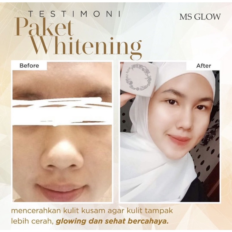 PAKET WHITENING + SERUM LUMINOUS MSGLOW