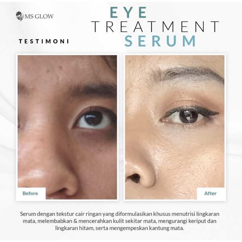 EYE SERUM MSGLOW EYETREATMENT SERUM