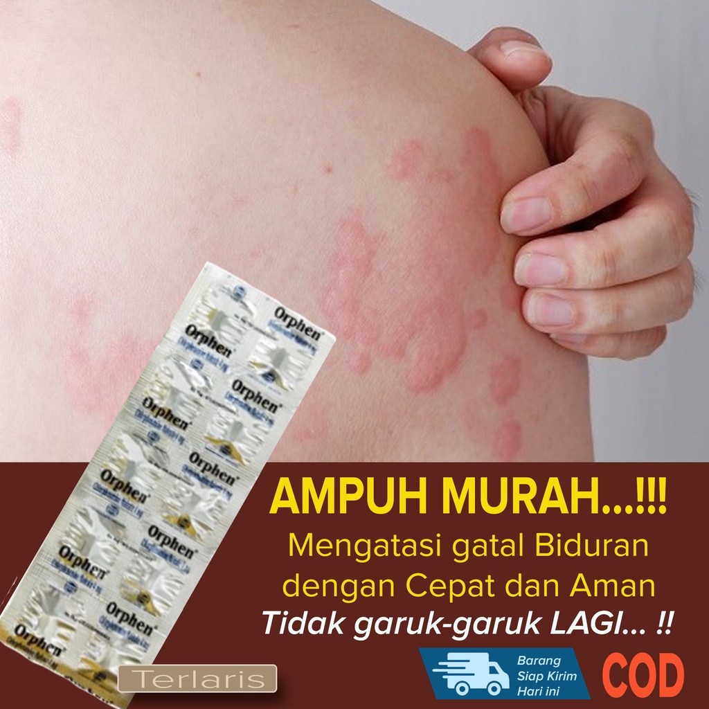 BEST SELLER Obat Biduran AMPUH MURAH Obat gatal Alergi Biduran juga Mengobati gatal Alergi Cuaca din