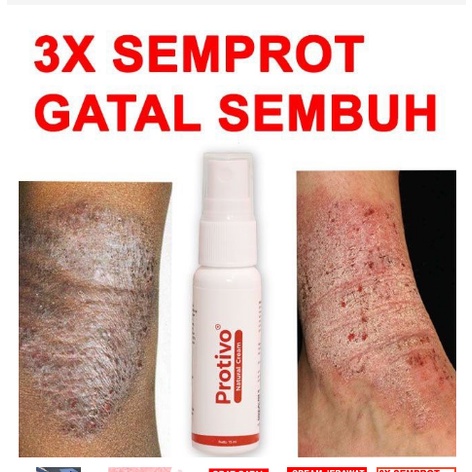 Protivo Natural Cream Original BPOM RI Obati Eksim, Obat Gatal gatal Menahun, Mengobati Jerawat