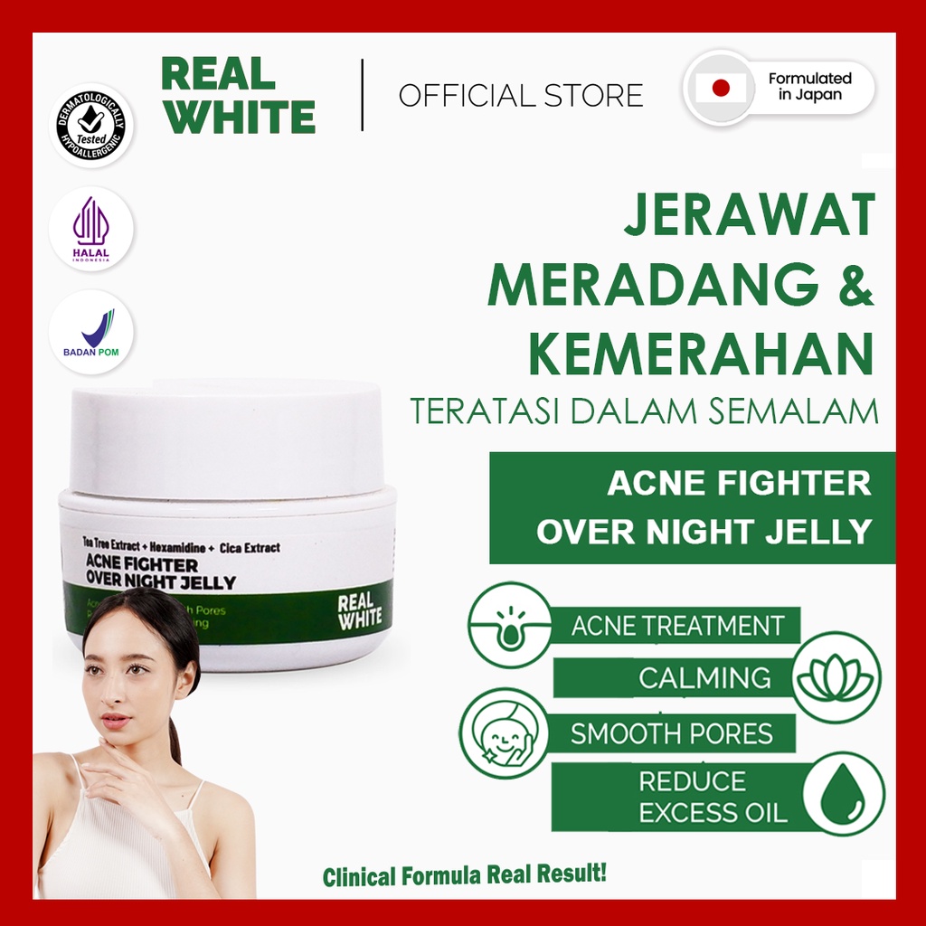 𝐑𝐄𝐀𝐋 𝐖𝐇𝐈𝐓𝐄 Acne Fighter Over Night Jelly Jerawat Meradang |BPOM HALAL Sleeping Mask Gel Skin Booster