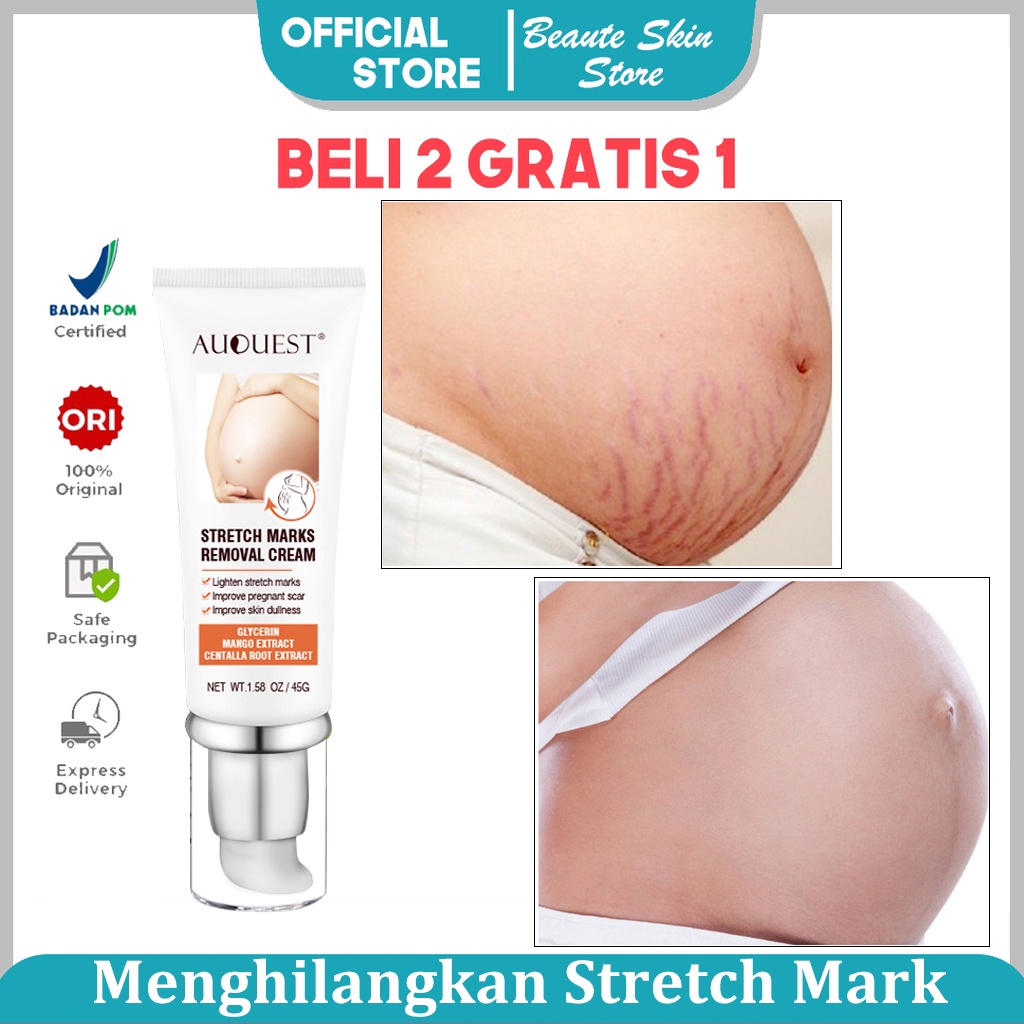 AUQUEST hamil perut tato krim perut firming cream memudar postpartum obesitas stretch mark perbaikan cream