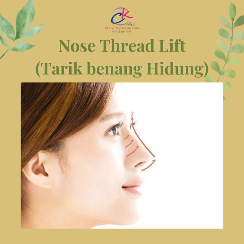 Nose Thread Lift (Memancungkan Hidung)