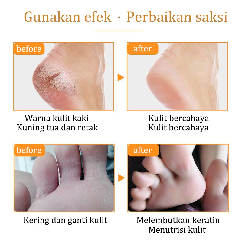 Anti pecah-pecah Krim kaki Krim tangan Tahan retak Minyak Kuda Tangan dan Kaki Retak Tumit Kering Retak Tumit Retak Anti Retak Perawatan Kaki Krim Penyembuhan