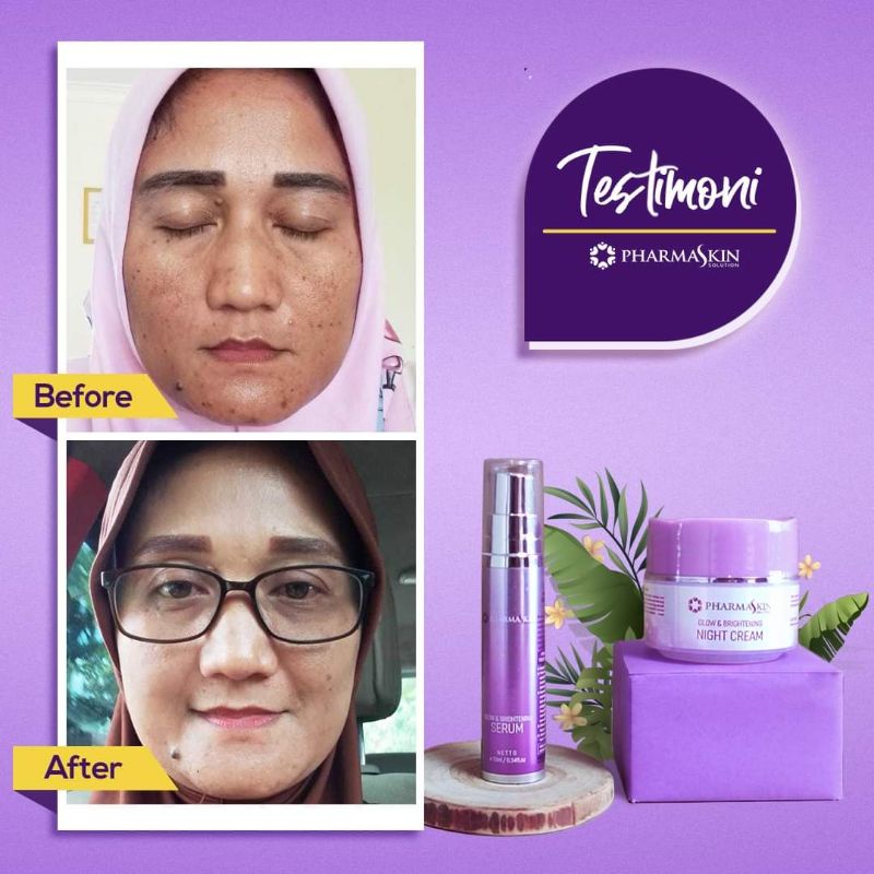 Paket Intensive Flek | Cream malam dan Serum by Pharmaskin Solution