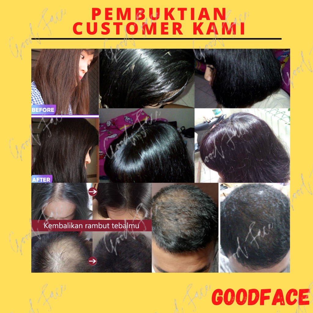 SHAMPO ANTI KETOMBE DAN RONTOK HAPPY SHAMPOO KEMIRIKU 100ML PERAWATAN RAMBUT PENGHILANG KETOMBE