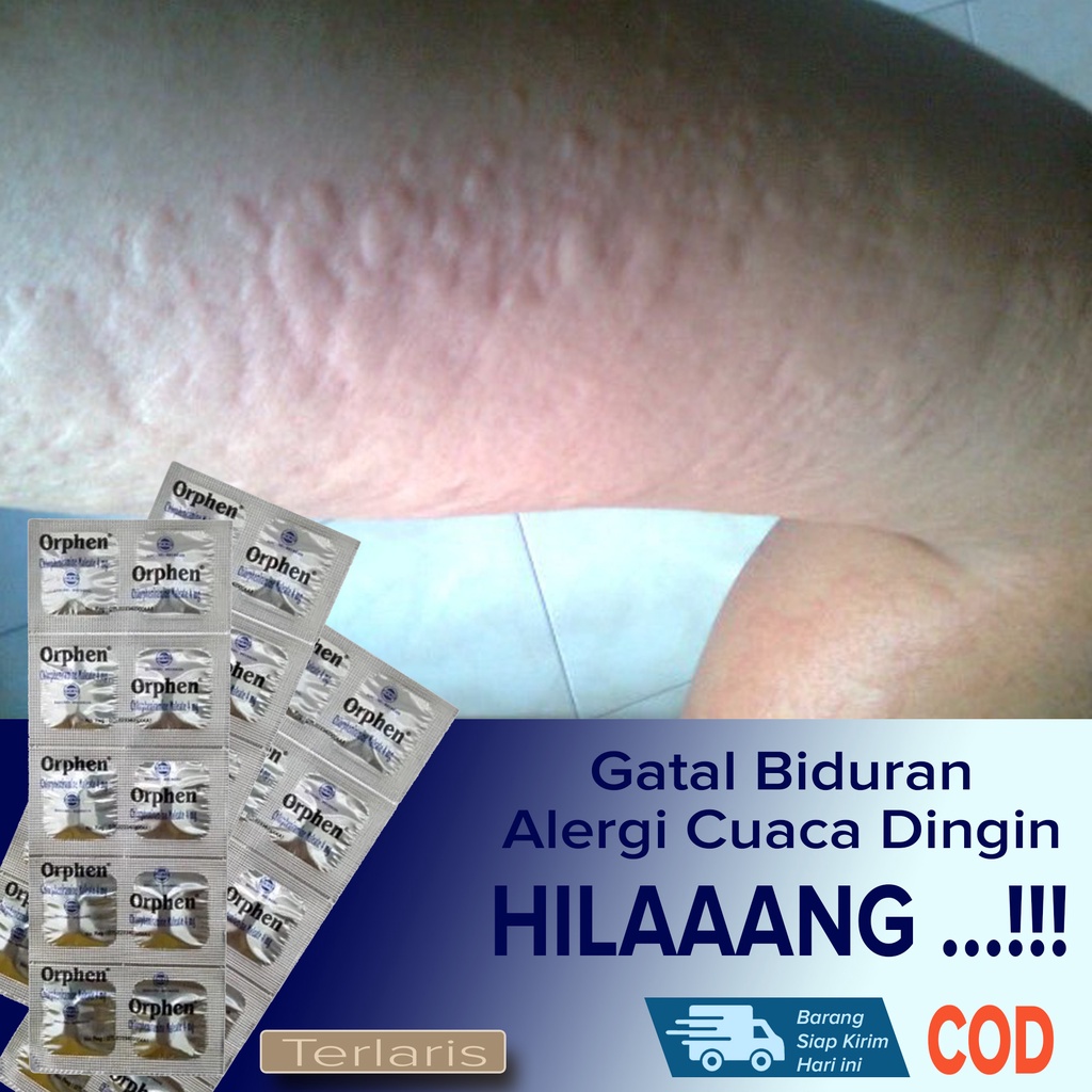 MURAH AMPUH Obat gatal Biduran mengobati Gatal Alergi Cuaca Alergi Makanan Alergi Gigi Berlubang dan