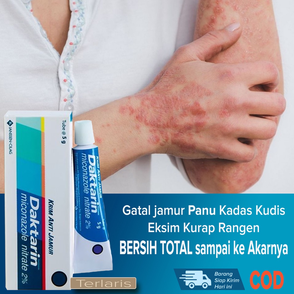 Salep Obat Gatal Kulit Jamur Panu Gatal Selangkangan Sela2 jari dll AMPUH Mengatasi jamur Kulit band