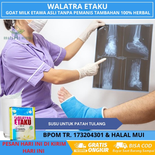 

Susu Tulang Patah, Tulang Retak, Susu Untuk Tulang Patah, Susu Kalsium Untuk Tulang Patah, Susu Penyambung Tulang Yang Patah Dgn Susu Kambing Etawa Bubuk