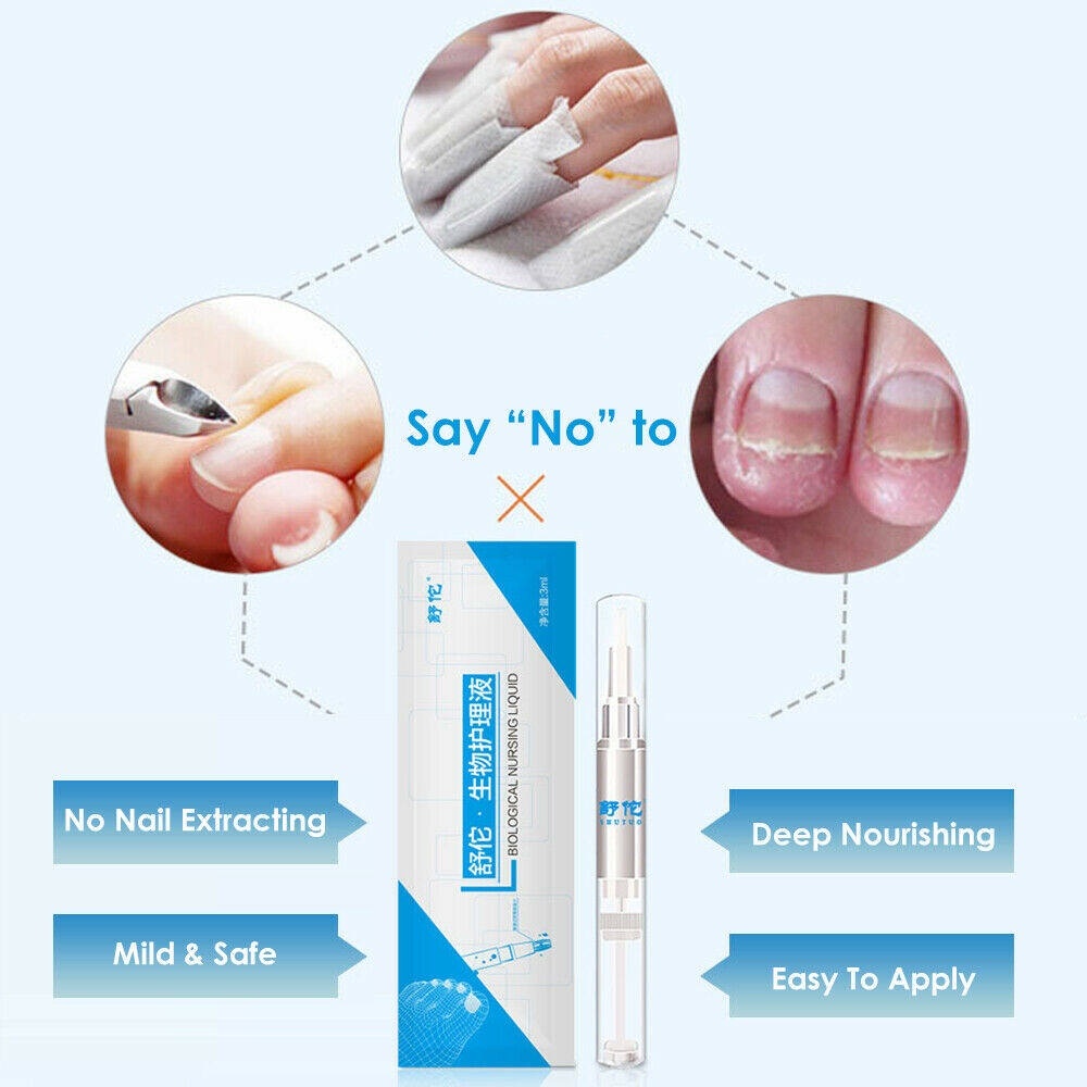 Beauty Jaya - Serum Perawatan Kuku Lanbena Nail Repair Essence Perawatan Kuku Jamuran
