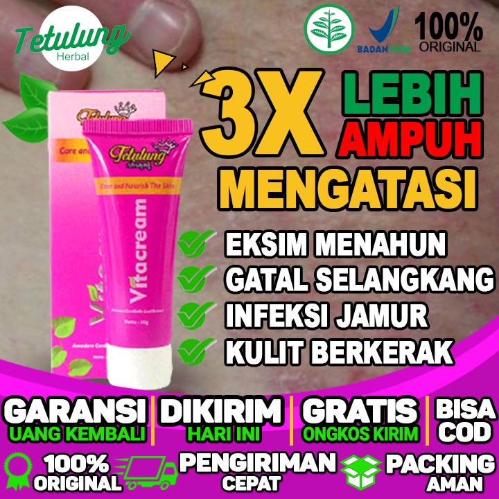 obat gatal jamur eksim obat eksim basah dan jamur eksim