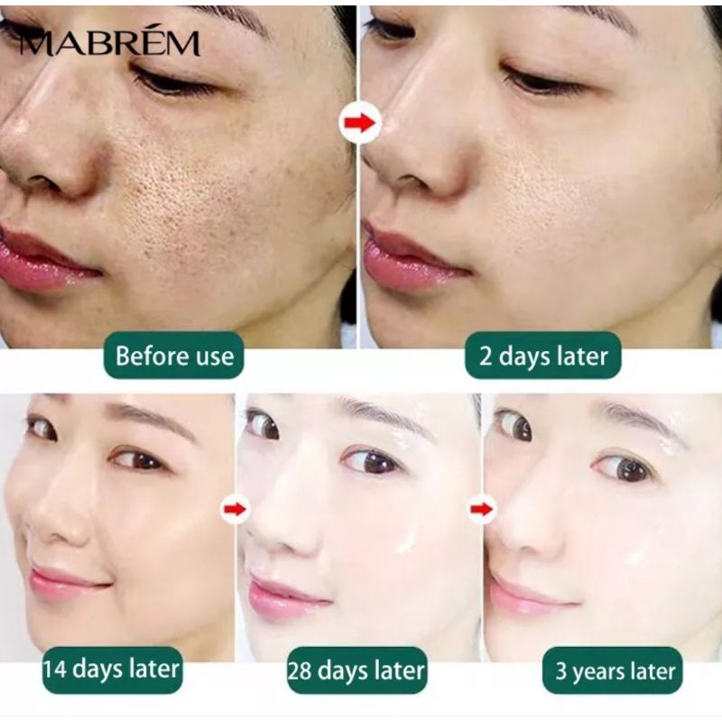 MABREM Face Serum Hyaluronic Acid Shrink Pores Regeneration Moisturizing Anti-Aging Skin Care Face Cream Acne Essence 10ml -Wajah Glowing Pemutih Mengecilkan Pori Anti-Penuaan Pelembab Wajah Esensi Perawatan Kulit Kering