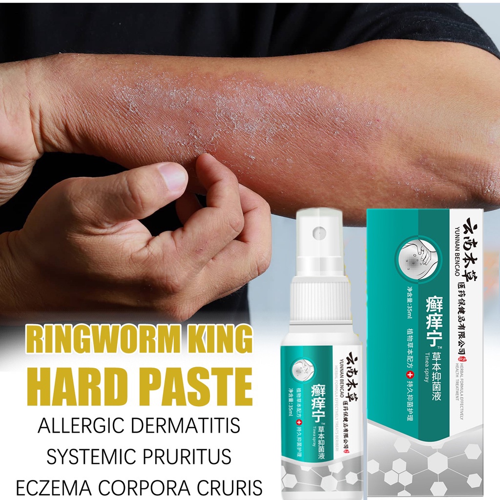 Salep Kulit Salep Eksim Salep Psoriasis Salep Gatal Paling Ampuh Krim Psoriasis 35 ml Semprotan Psor
