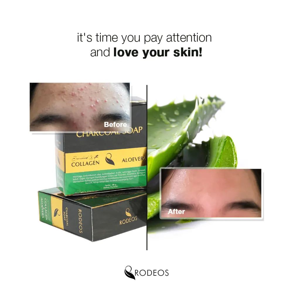 Rodeos Charcoal Soap - Paket Isi 3 Pcs Sabun Muka Pria untuk Kulit Kusam &amp; Jerawat