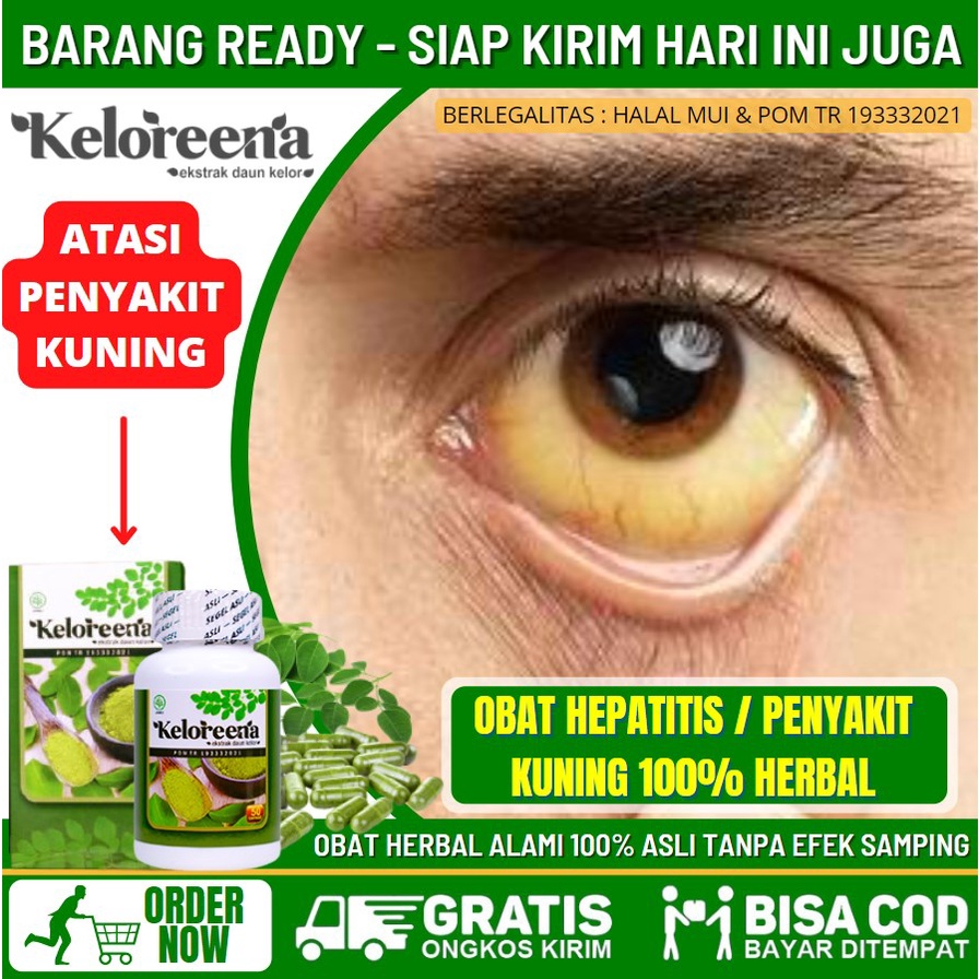 Obat Pencerah Mata, Mempertajam Penglihatan, Obat Tradisional Mata Kuning, Mata Koneng, Obat Ikterus