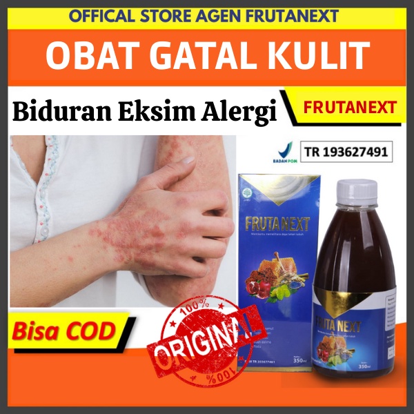 Obat Kulit Gatal Paling Ampuh Obat Biduran Kulit Frutanext Ampuh