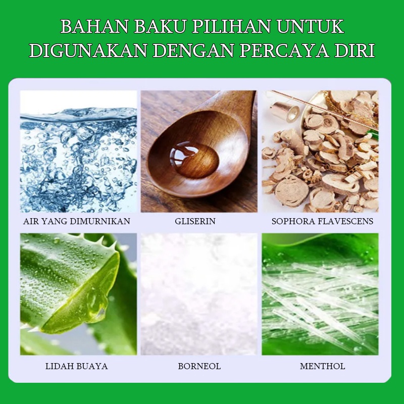 Salep gatal Salep Eksim Salep kulit Krim psoriasis paling ampuh Kulit Kepala Psoriasis Tangan Tinea Kaki Bau Versicolor Menghambat Dermatitis Jamur Anti Gatal Cream 30G