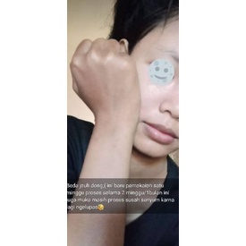 Direkomendasikan--nirmala skincare cream malam jerawat